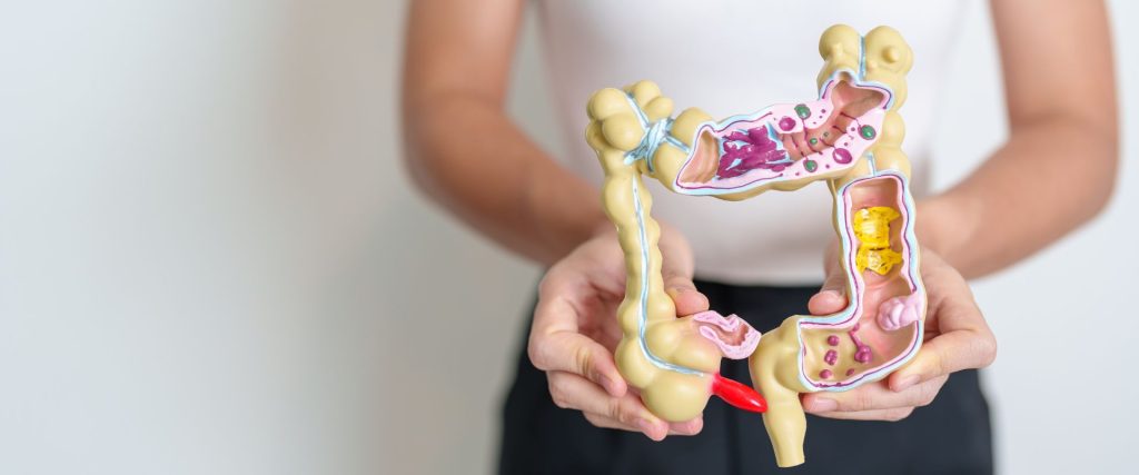 Colonic Hydrotherapy